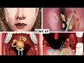 Download Lagu ASMR Treatment of the Chinese zombie bride into a beautiful girl - 아름다운 소녀로 중국 신부의 치료