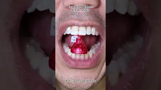 The Most Satisfying Chocolate & Candy ASMR Compilation