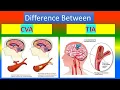Download Lagu Difference between CVA and TIA