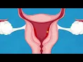 Download Lagu How does mifepristone work?