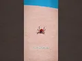 Download Lagu How To Remove A Tick 🤢
