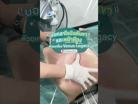 บอกลาไขมันต้นขาและหน้าท้อง ด้วย #VenusLegacy ที่ #TermtemClinic #เติมเต็มคลินิก
