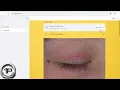 Final Year Project Skin Dermatology Using CNN 2D OpenCV Image Processing Python - DL and ML
