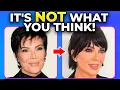 Kris Jenner s Face Explained Deep Plane Facelift or Something Else