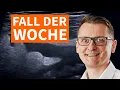 Download Lagu Fall der Woche - Wie du Darmsonographie systematisch anwendest \u0026 befundest - Abdomen Aufbaukurs