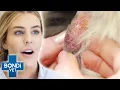 Will Vet Pop Cyst On Dog s Neck Bondi Vet