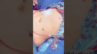 ماکو سلامات رزان محمد تجميل میکاب مودل جكجكني 