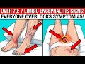 OVER 70 7 Limbic Encephalitis Warning Signs Everyone Overlooks