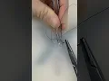 Simple Running Sutures