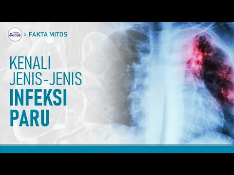 Tak Hanya TBC, Ini Jenis-Jenis Infeksi Paru dan Risikonya