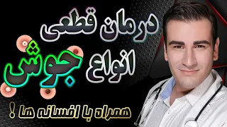 درمان سریع جوش صورت و افسانه های آن                                                                دندنها