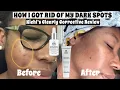 HOW I GOT RID OF MY DARK SPOTS WITH KIEHL S CLEARLY CORRECTIVE RANGE