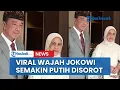 Download Lagu Terbongkar Sudah Sakit Jokowi Sebenarnya, Wajahnya Semakin Putih Saat Berfoto Jadi Sorotan