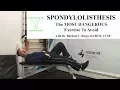 Spondylolisthesis - The Most Dangerous Exercise To Avoid