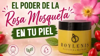 LA ROSA MOSQUETA Y LA PIEL
