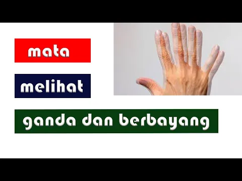 Download MP3 MATA MELIHAT GANDA || MATA MELIHAT BERBAYANG || DIPLOPIA