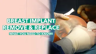 Breast Implant Removal Replacement What You Need to Know Dr Rahal Explains LIVE surgery