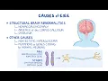 Understanding Early Infantile Epileptic Encephalopathy EIEE Rare Seizure Disorder