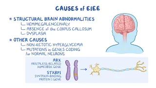 Understanding Early Infantile Epileptic Encephalopathy EIEE Rare Seizure Disorder