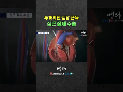 두꺼워진 심장 근육을 잘라내는 수술