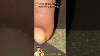 استخراج الذهب من الأحجار بعد الطحن ملك المناجم 