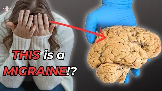 Why Migraines Are More Than Just a Headache