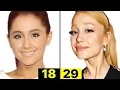 Lagu What Happened to Ariana Grande's Face? | Plastic Surgery Analysis