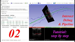 Python Interact PyCharm Debug 3D Slicer Pipeline -