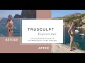 TRUSCULPT EXPERIENCE HONEST REVIEW WITH BEFORE AND AFTER PICTURES getawei
