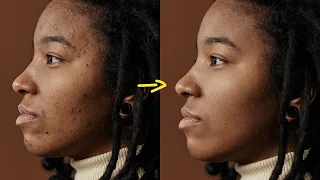 How to Quickly REMOVE PIMPLES Blemishes in Photoshop Photo Editing Tutorial