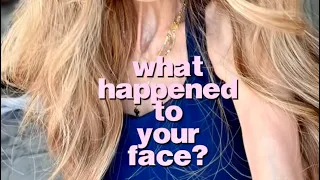 Whats wrong with your face?