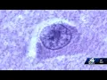 Researchers medical experts share what they know on brain-eating amoebas