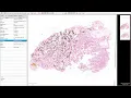 Setting stain vectors in Qupath