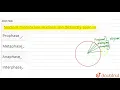 Nuclear membrane nucleoli are distinctly seen in