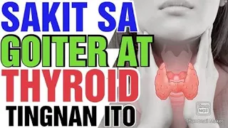 sakit sa thyroid at goiter tingnan ito by doc willie ong