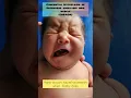 congenital absence of depressor angularis oris muscle - baby