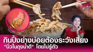 จะป้องกันโรคนิ่วในถุงน้ำดีได้อย่างไร