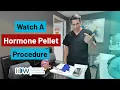 Low Hormones Energy Crash Watch This HRT Pellet Procedure in Action