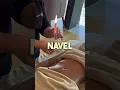 I Tried Navel Candling with a Belly Massage to Improve my Digestive System