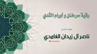 رقية سرطان و اورام الثدي الشيخ ناصر ال زيدان الغامدي 