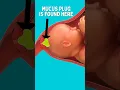 Mucus Plug vs Bloody Show