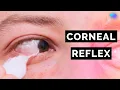 Corneal Reflex Assessment CN V OSCE Clip UKMLA CPSA PLAB 2