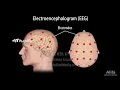 Sleep Physiology, Animation