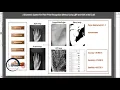 A Biometric Authentication System By Palm Print Verification Using LBP and KNN in MATLAB - DIP