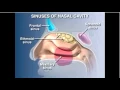 nasal sinus anatomy