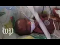 ‘I feel blessed’: Meet Saybie, the world’s smallest surviving baby