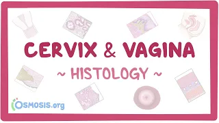 Download Cervix and vagina: Histology MP3