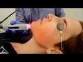 laser hair removal NIGHTMARE footage graphic