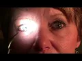 Relative Afferent Pupillary Defect RAPD