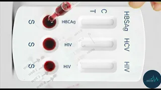 HOW TO Use 11-Panel STD Test Kit at Home HIV Herpes Chlamydia